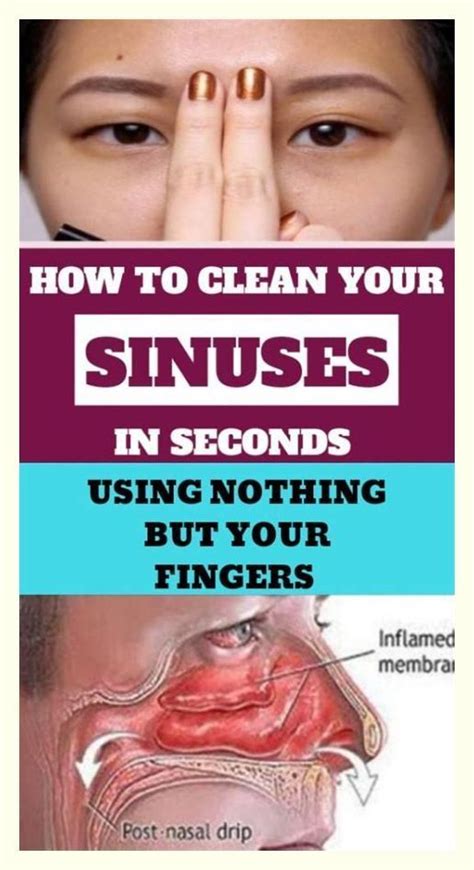 How To Clear Sinuses Artofit