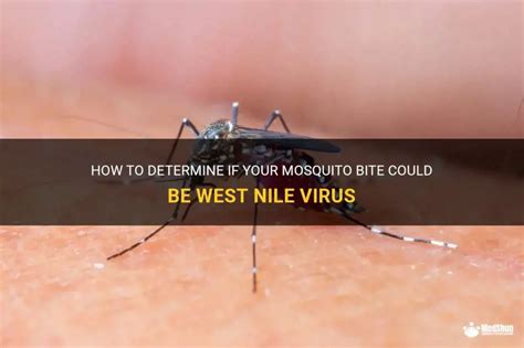 How To Determine If Your Mosquito Bite Could Be West Nile Virus Medshun