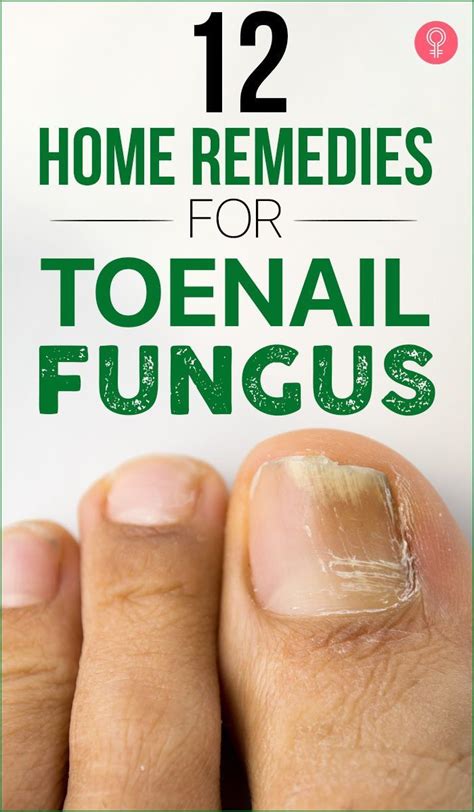 How To Treat Toe Nail Fungus Effective Home Remedies