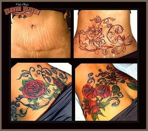Stomach Tattoos To Cover Tummy Tuck Scar