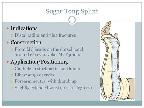 Best Sugar Tong Splint Techniques for Quick Healing