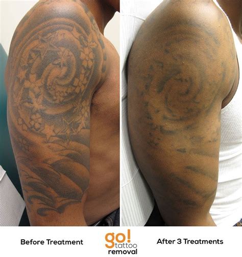 Why Do Tattoos Need To Be Wrapped At Wayne Tisdale Blog